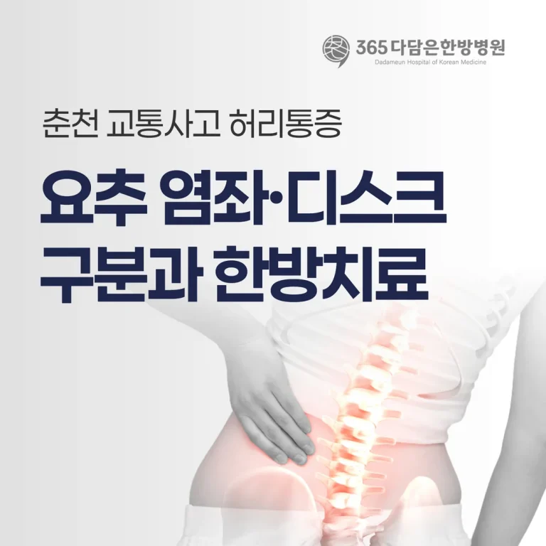 춘천 교통사고 허리통증, 요추 염좌·디스크 구분과 한방치료