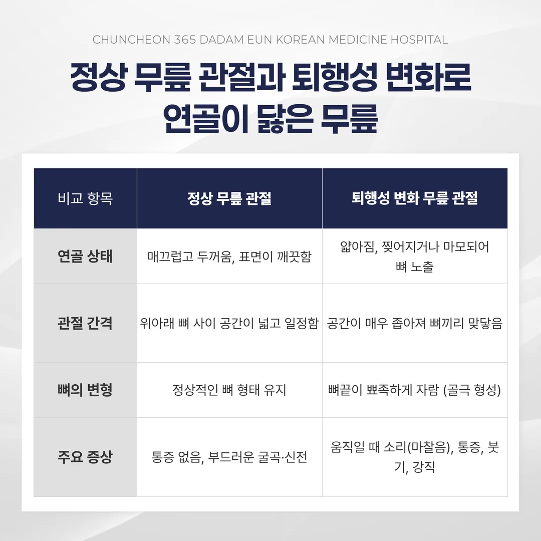 정상 무릎 연골과 퇴행성 무릎 관절염의 연골 손상 비교