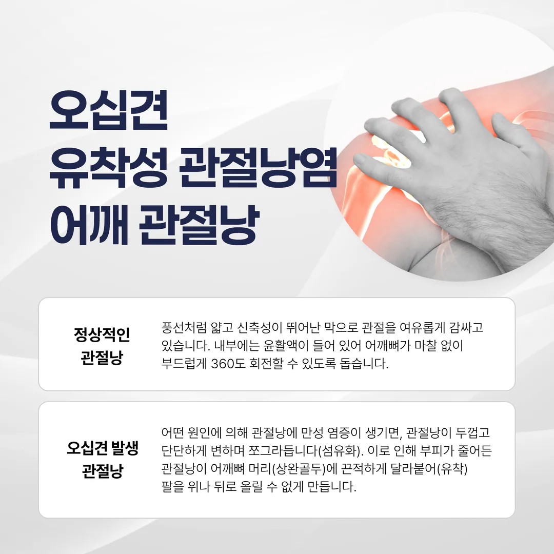 오십견 유착성 관절낭염 어깨 관절낭 구조 설명 그림