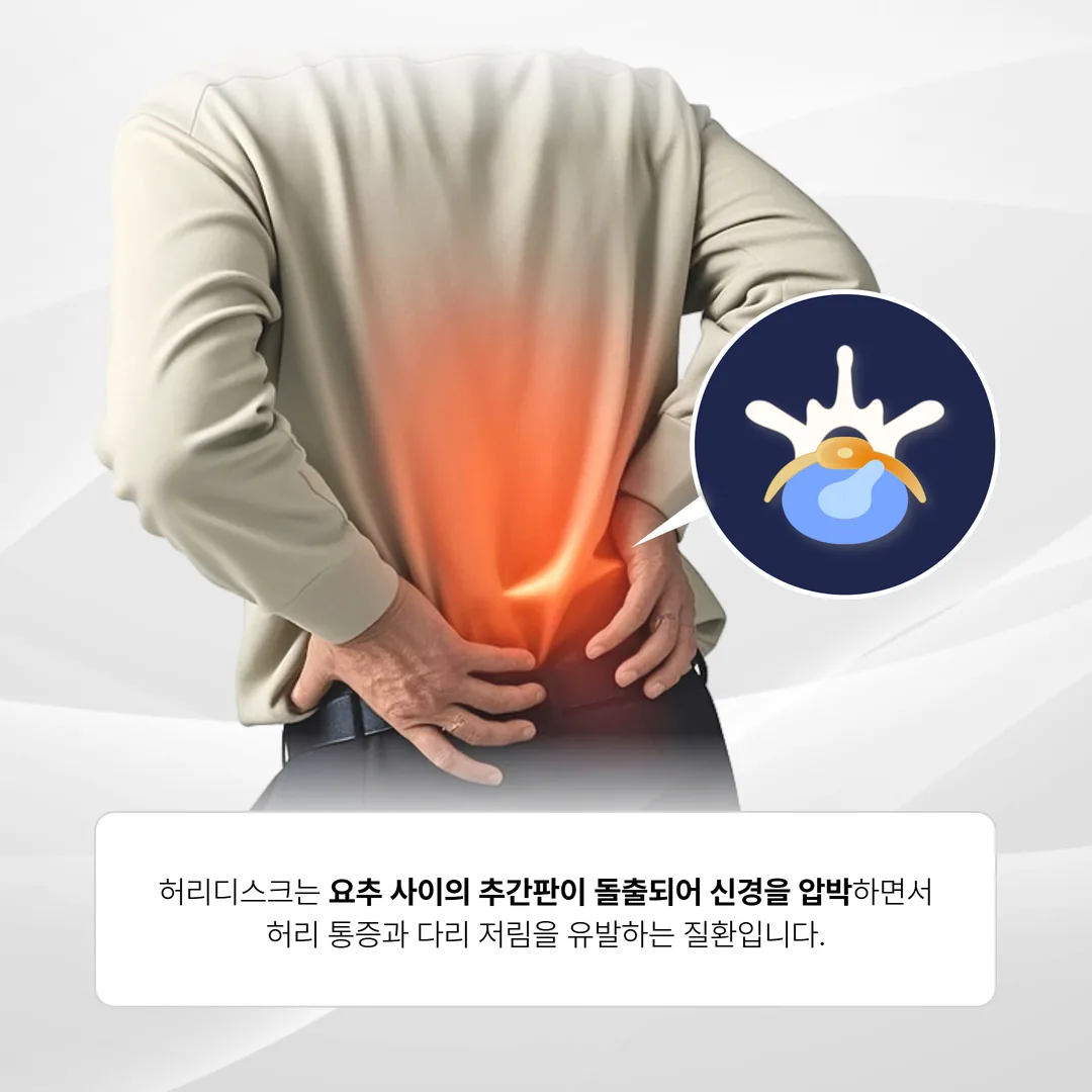 춘천 허리디스크 비수술 치료 판단 기준 안내 대표 이미지