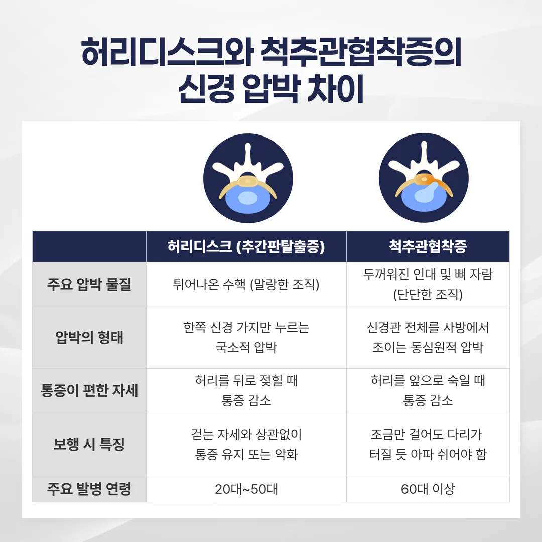 허리디스크 척추관협착증 차이 비교 그림