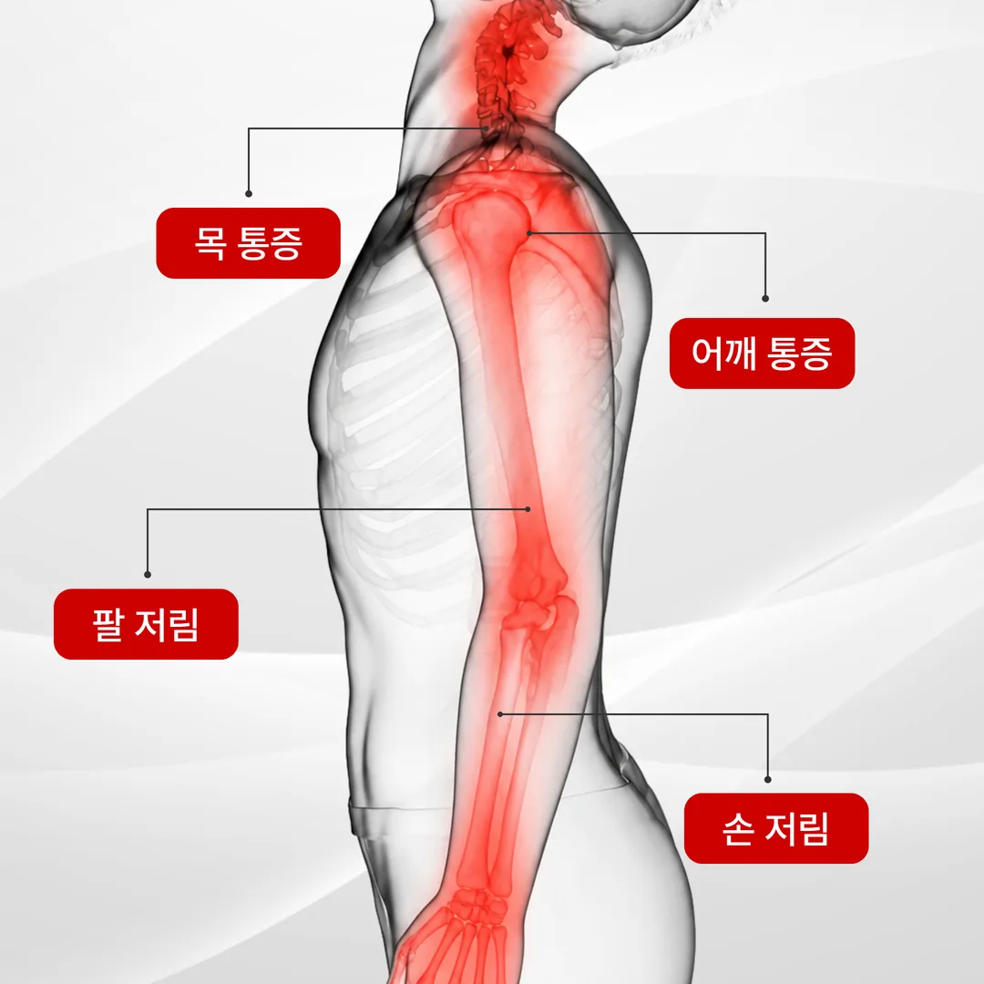 경추·요추 통증과 두통·어지럼 등 교통사고 후유증 부위별 주요 증상 정리
