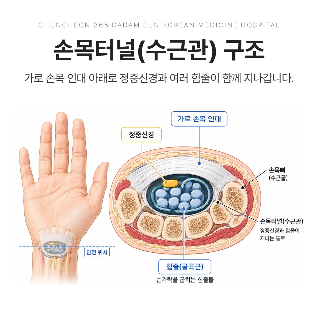손목터널(수근관) 구조와 정중신경의 위치