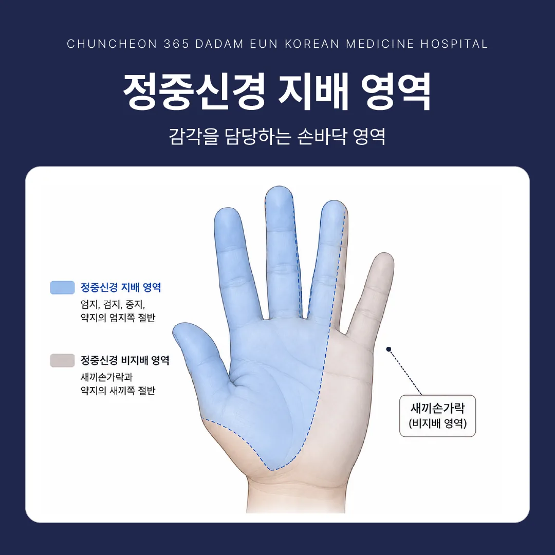 정중신경 지배 영역과 새끼손가락이 제외되는 범위