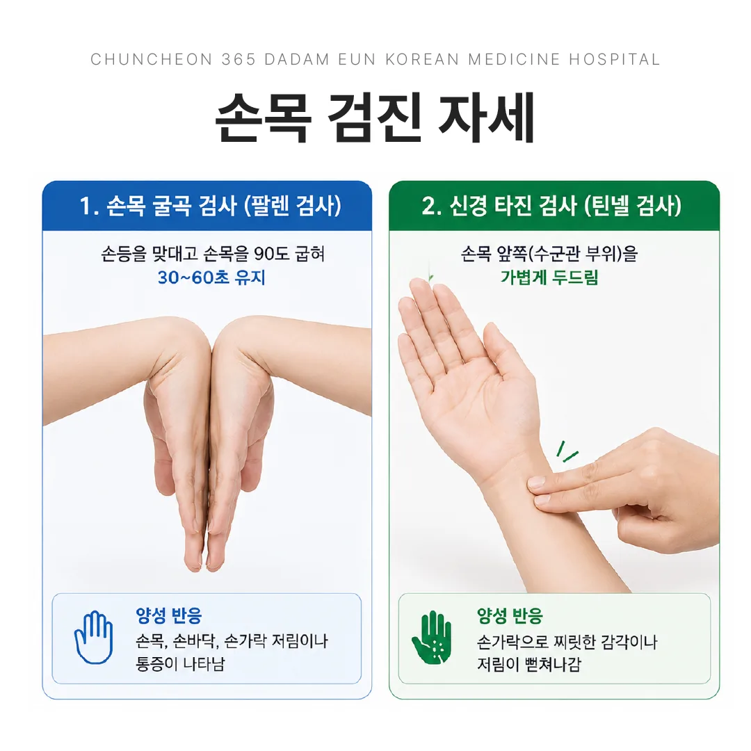 손목 굴곡 검사(팔렌)와 신경 타진 검사(틴넬) 자세