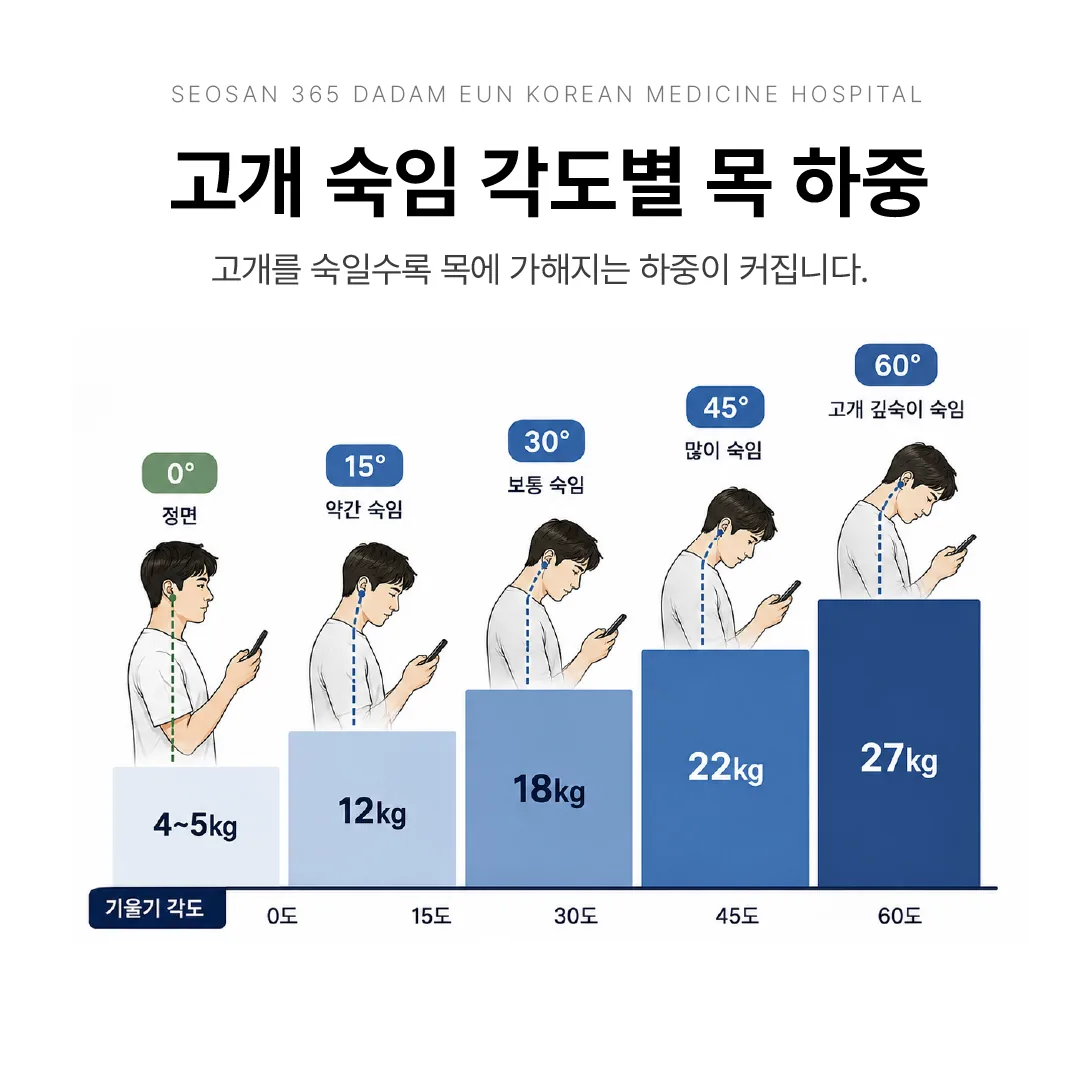 고개 숙임 각도별 목 하중 증가 그래프