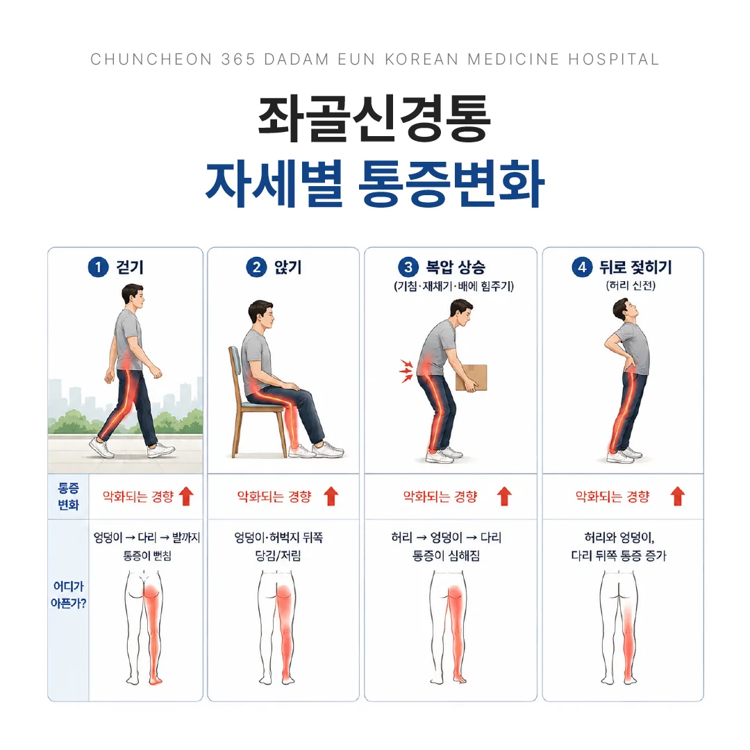좌골신경통 자세별 통증 변화 자가 체크