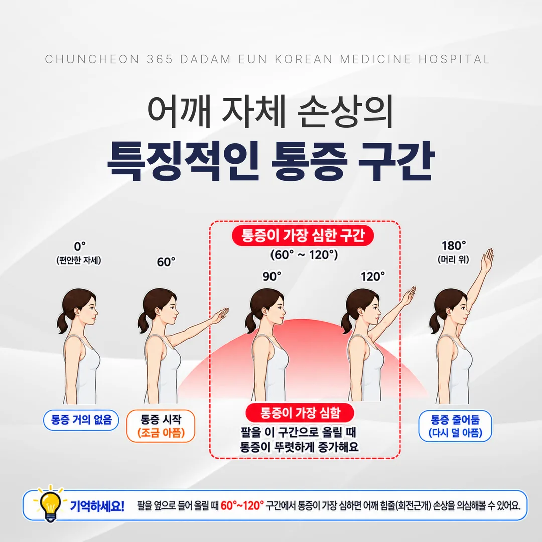 어깨 자체 손상의 특징적인 통증 구간 도해