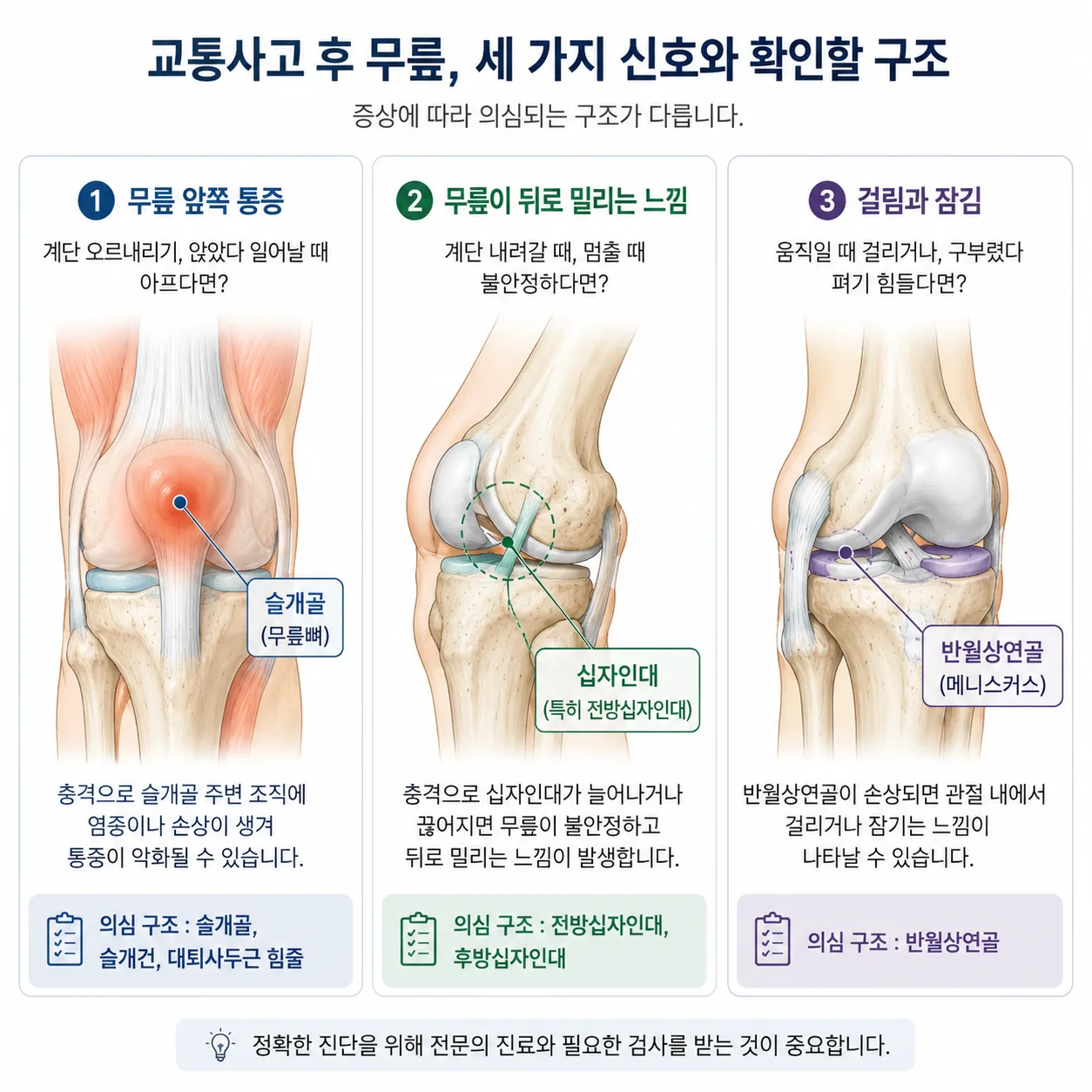 교통사고 후 무릎 증상별로 확인할 구조 표시 그림