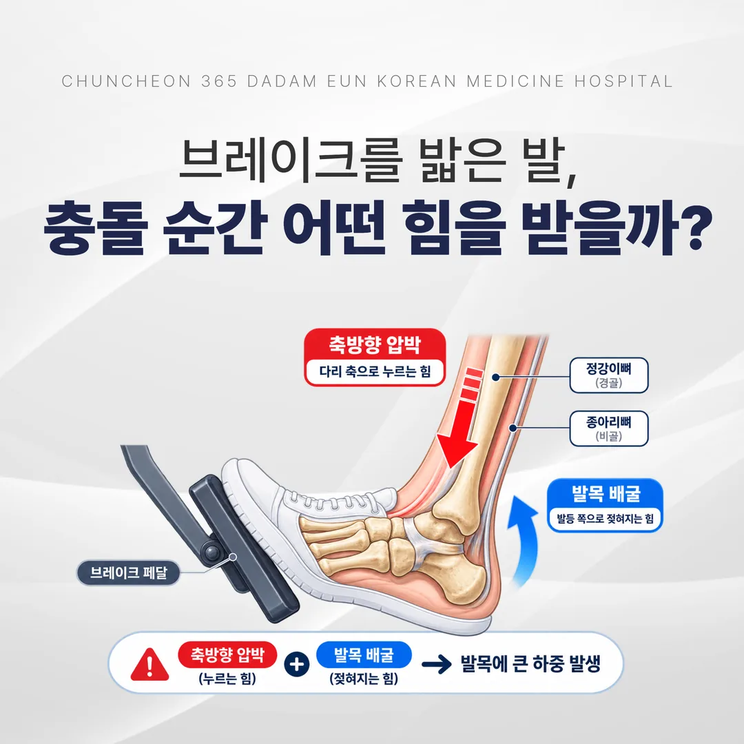 브레이크 페달 하중으로 발목이 젖혀지며 축방향으로 눌리는 기전 도해