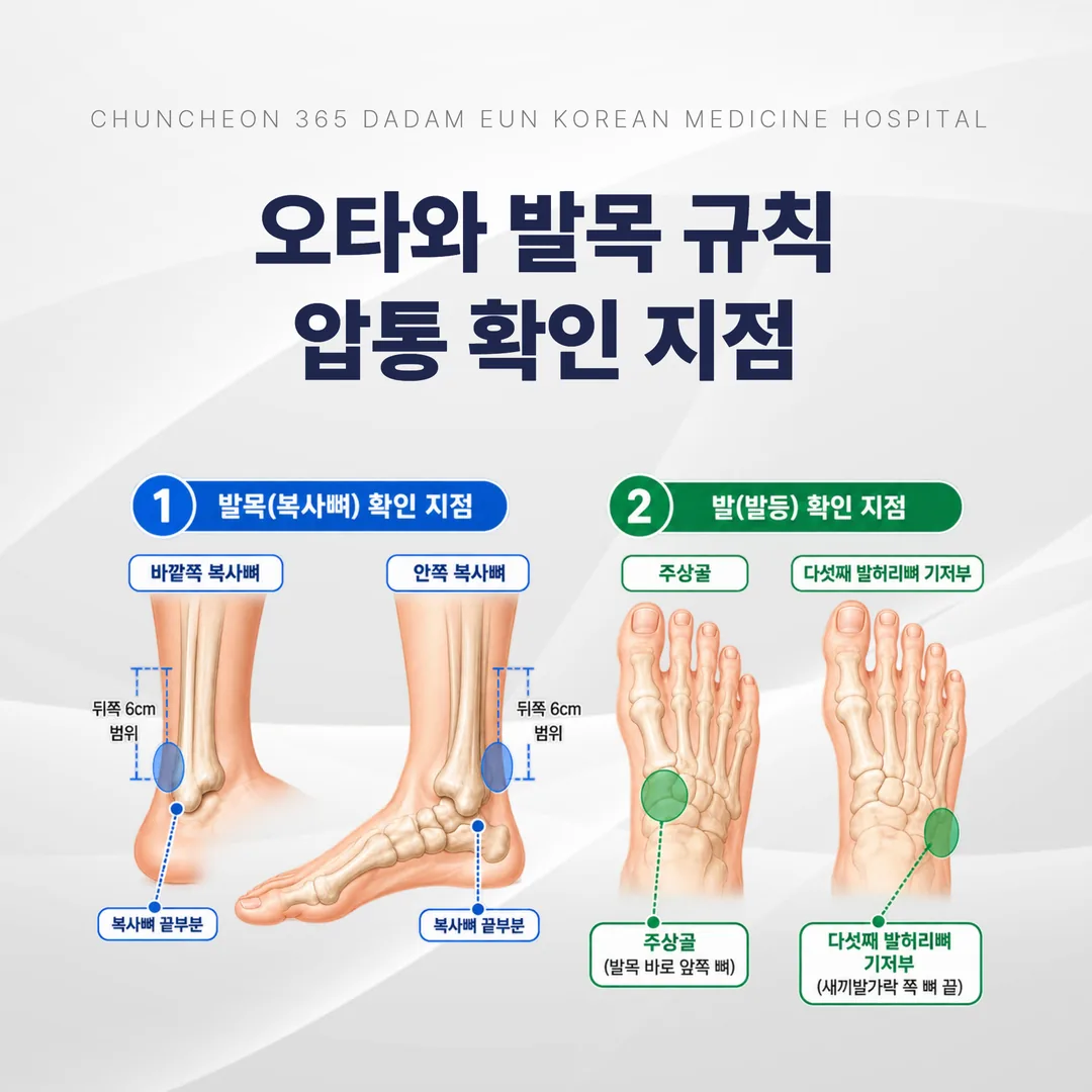 오타와 발목 규칙에서 확인하는 복사뼈와 발 중간 압통 지점