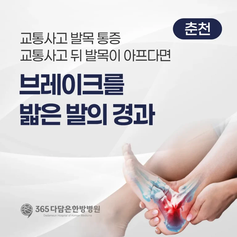 교통사고 뒤 발목이 아프다면 — 브레이크를 밟은 발의 경과 (춘천)