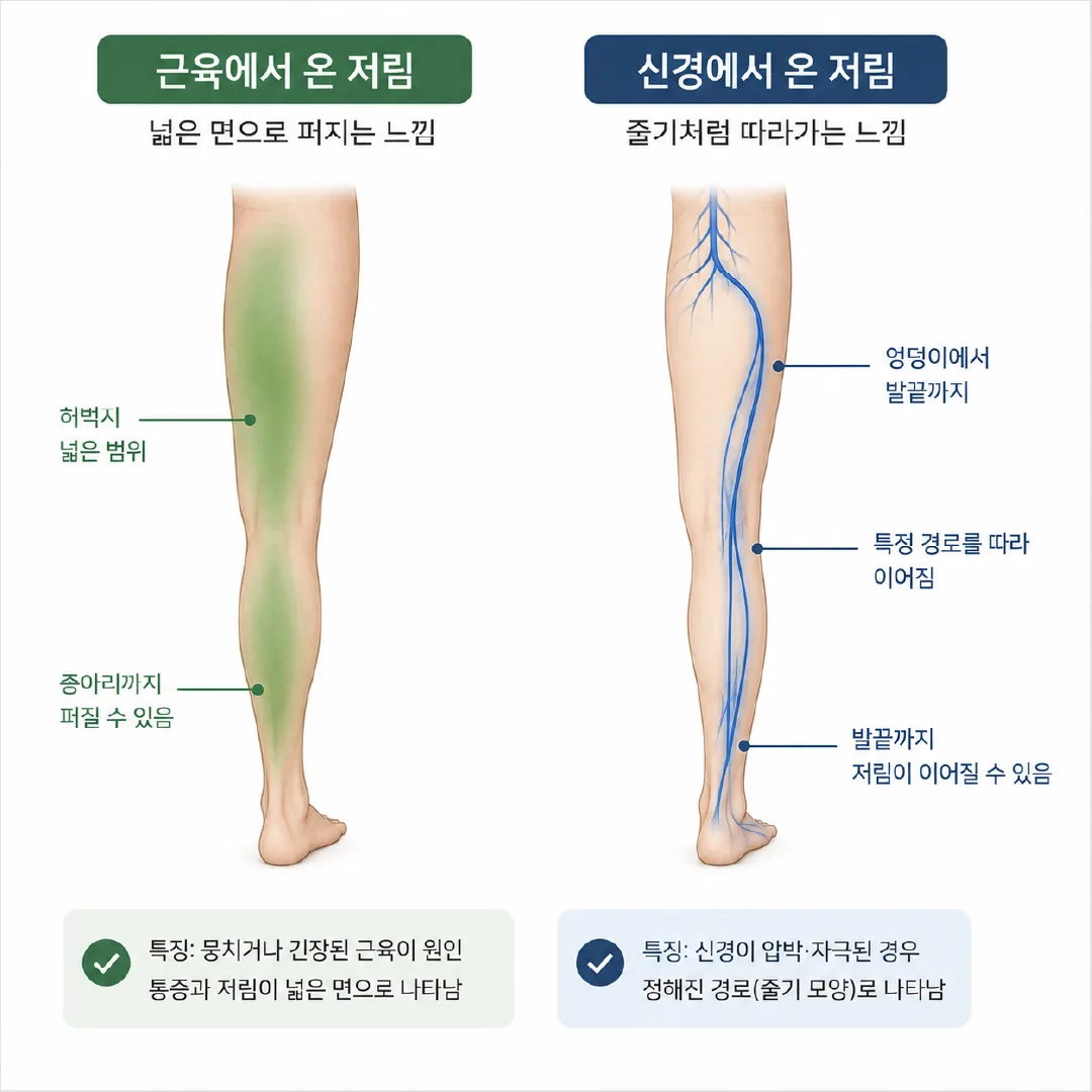 교통사고 다리 저림의 근육성 분포와 신경성 분포 비교
