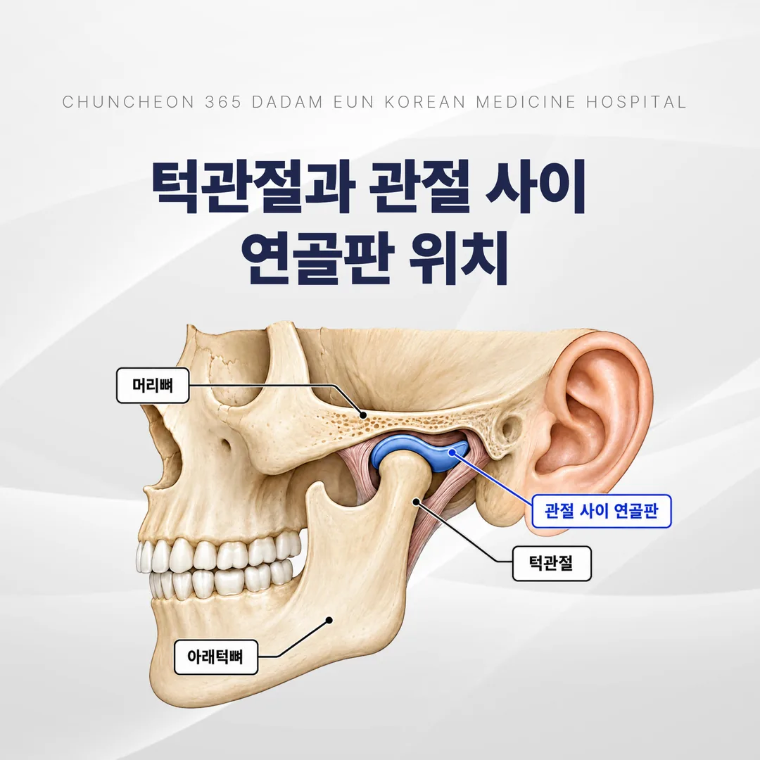 턱관절과 관절 사이 연골판의 위치를 보여주는 측면 그림