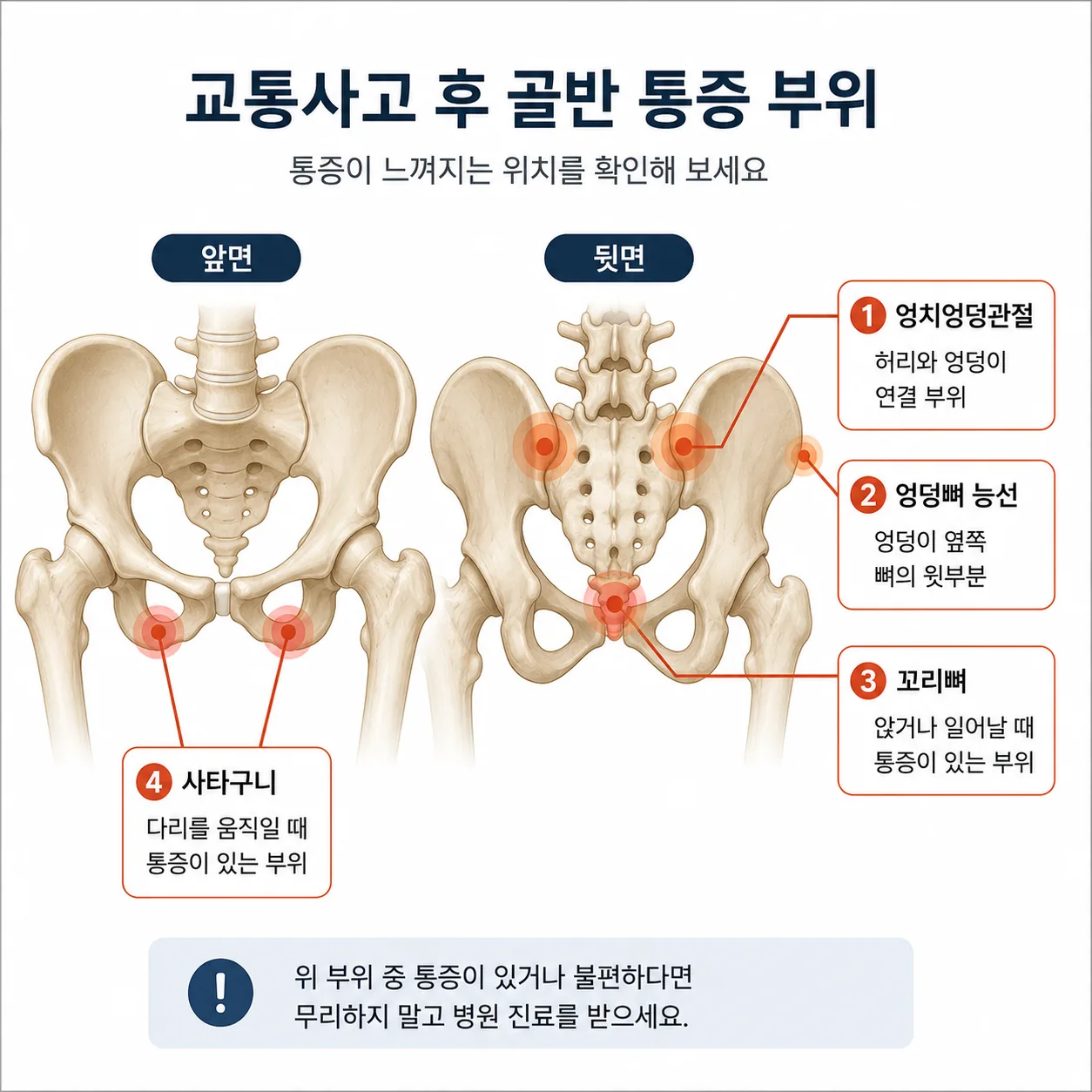 교통사고 후 골반 통증이 나타나는 부위별 위치 그림