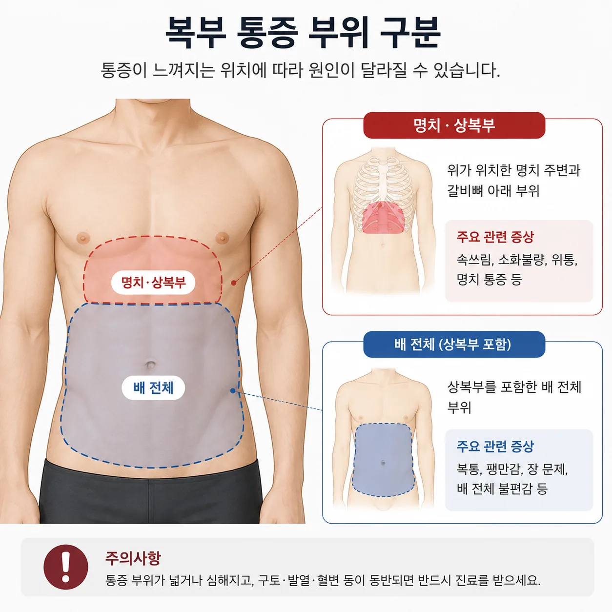상복부와 복부 전체를 구분한 복부 구역 도해