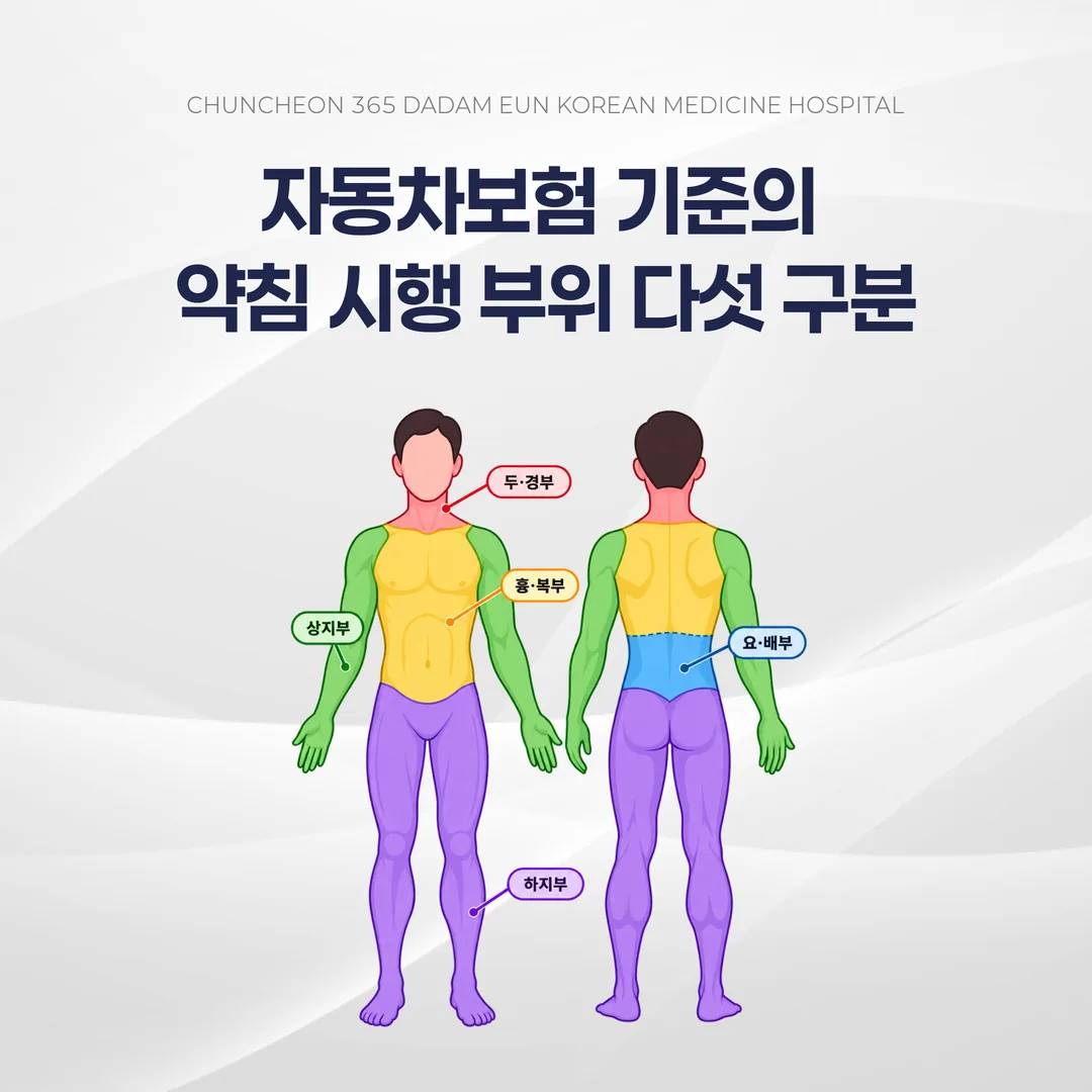 자동차보험 기준의 약침 시행 부위 다섯 구분