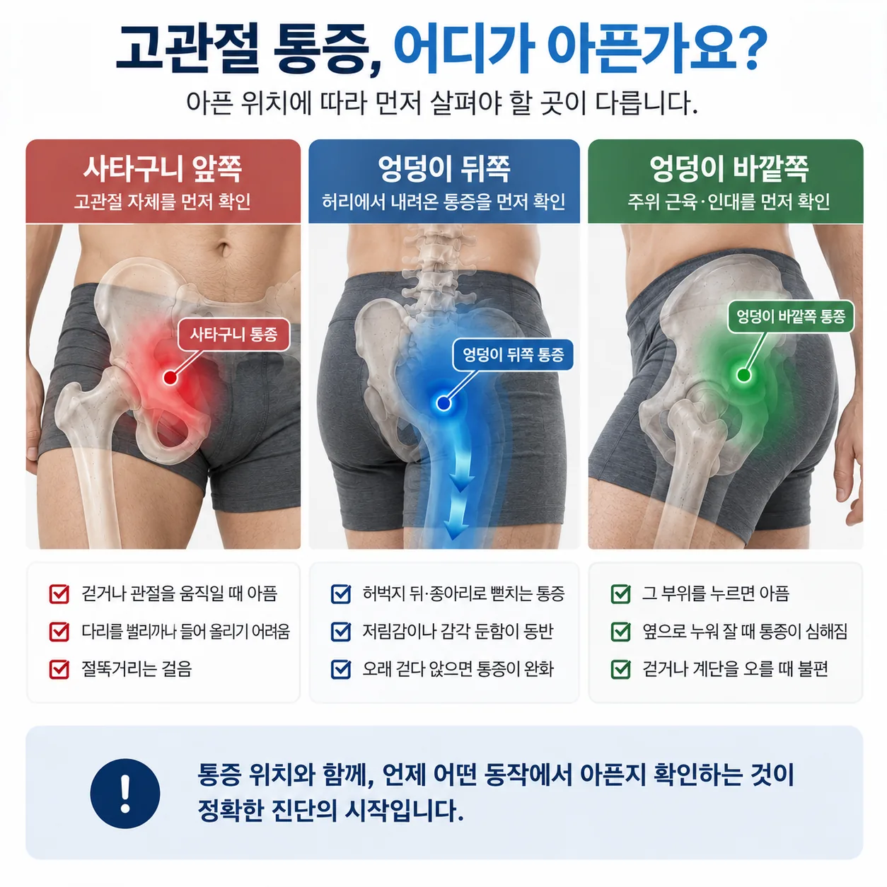고관절 통증을 아픈 위치에 따라 세 구역으로 나눈 그림