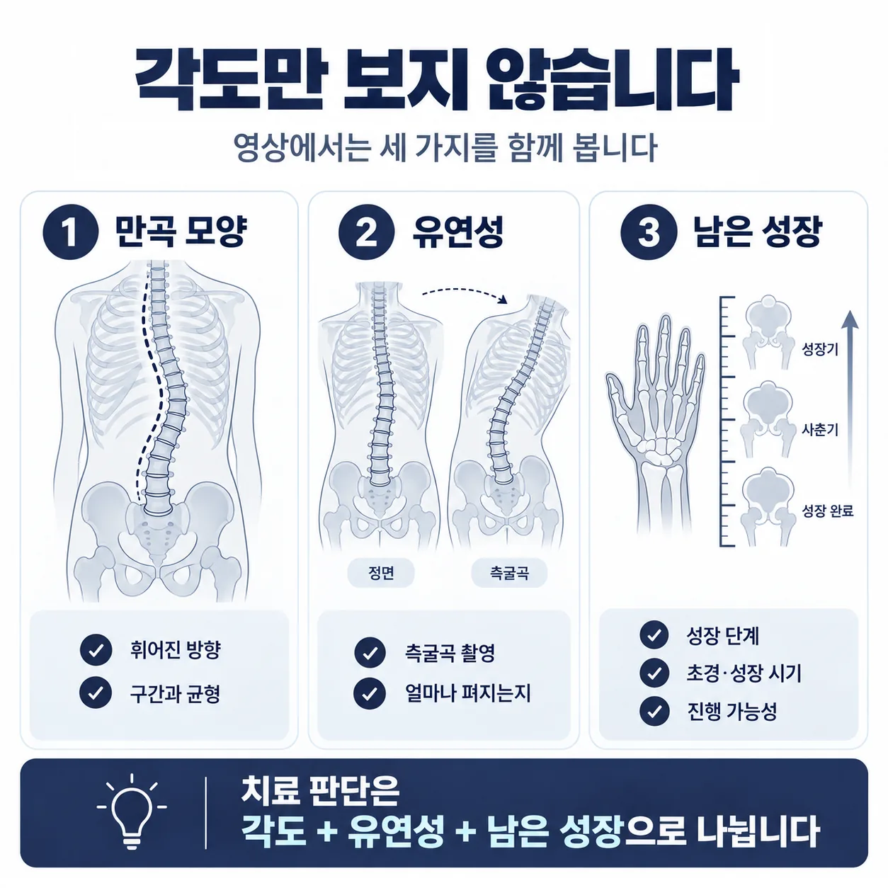 척추측만증 영상검사에서 각도와 함께 확인하는 항목을 만곡 모양·유연성·남은 성장으로 나눈 도식