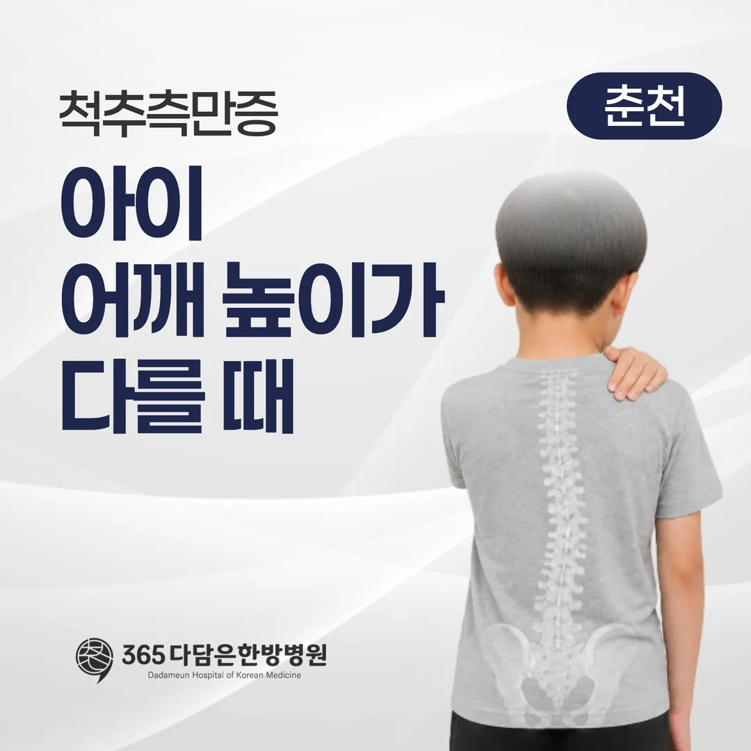 척추측만증, 아이 어깨 높이가 다를 때 — 관찰과 치료를 나누는 기준