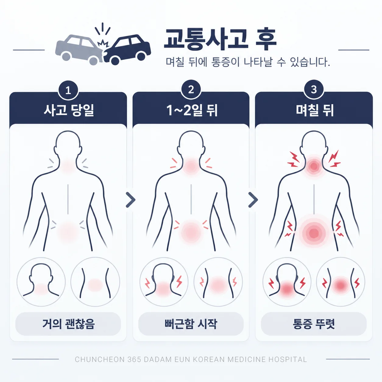 교통사고 뒤 며칠 사이 목과 허리 둘레가 붓고 굳으며 통증이 뚜렷해지는 흐름 도식