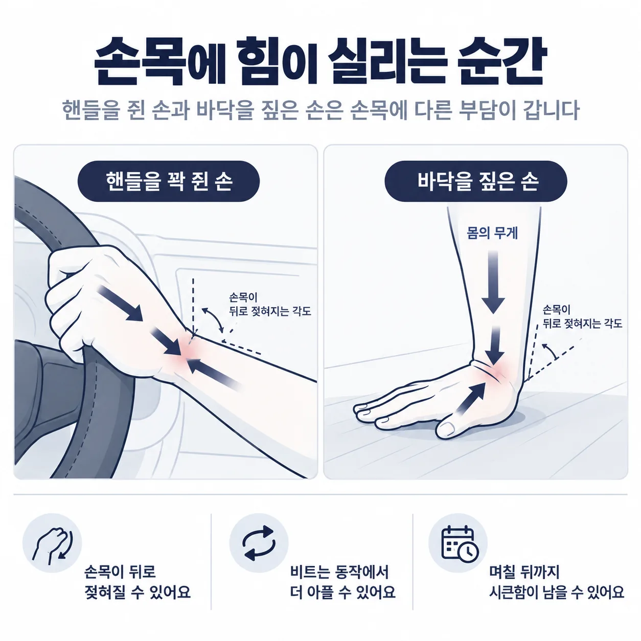 교통사고 때 핸들을 쥔 손과 짚은 손에서 손목으로 힘이 전해지는 방향 도식