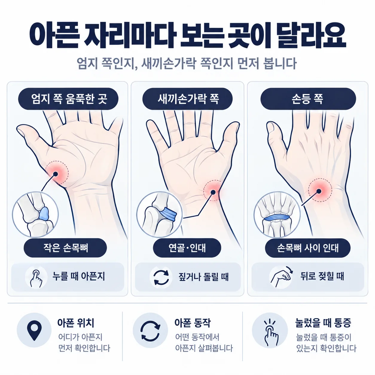 손목 통증 자리별 진찰 안내도, 엄지 쪽 움푹한 곳과 새끼손가락 쪽과 손등 쪽