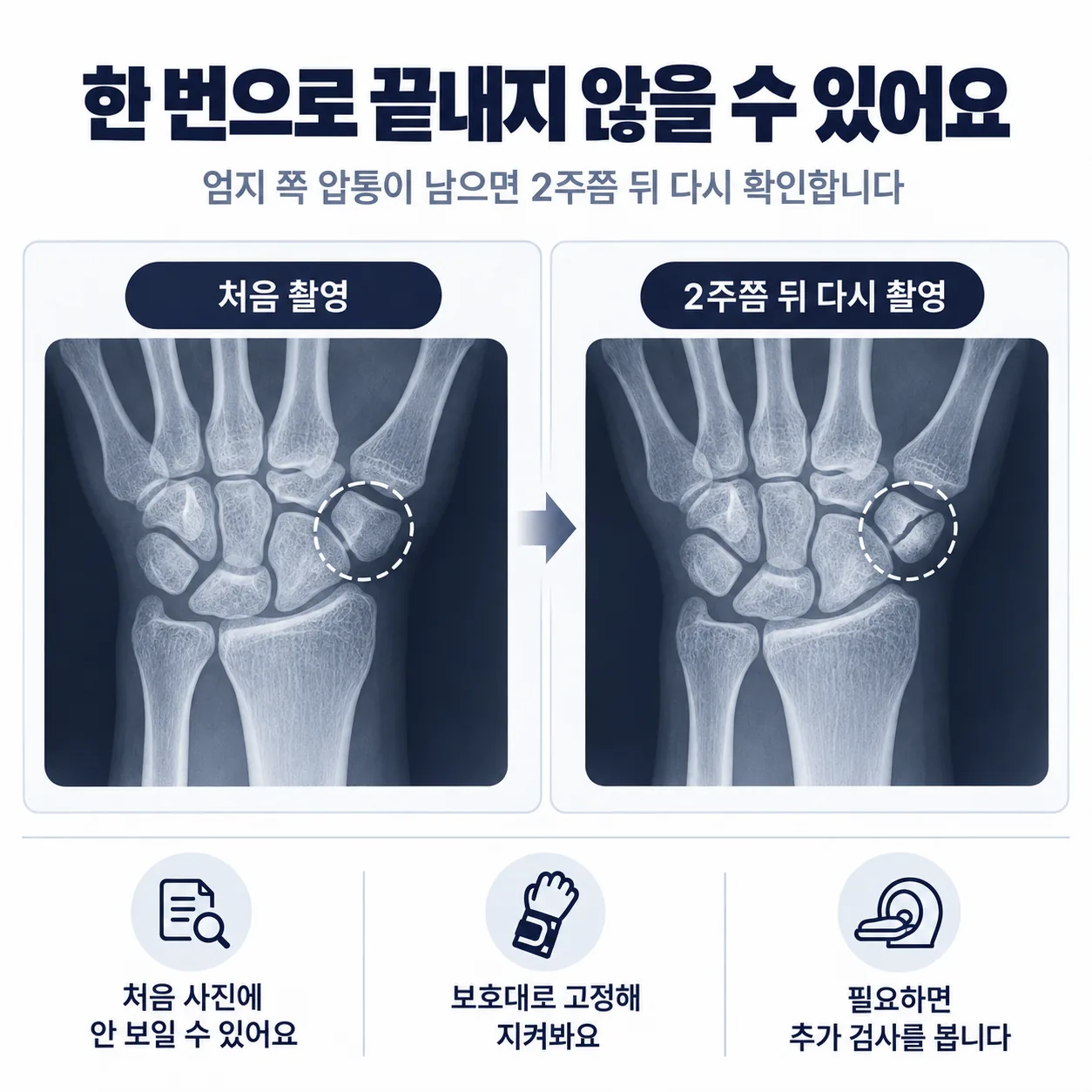 교통사고 손목 통증 때 손목을 덜 쓰는 생활 요령 네 가지 카드