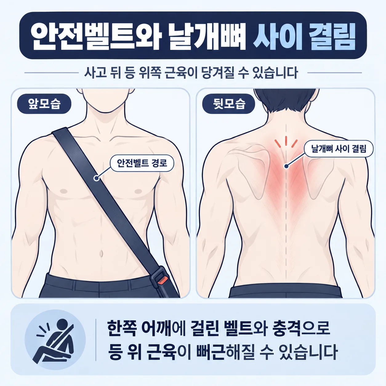 앞모습의 안전벨트 선과 뒷모습의 날개뼈 사이 결림 부위를 두 칸으로 표시한 도식