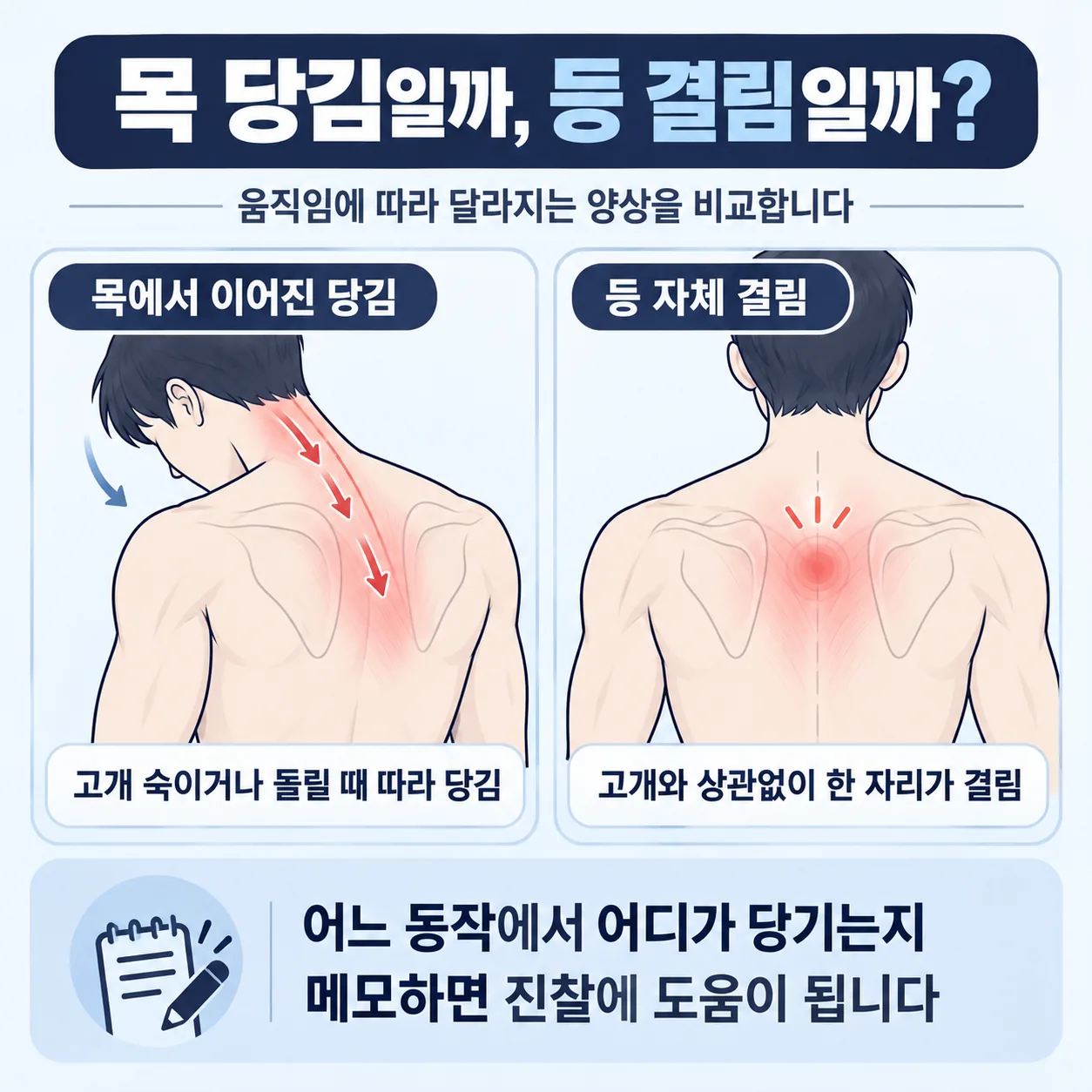 목에서 이어진 당김과 등 자체 결림을 두 칸으로 비교한 도식
