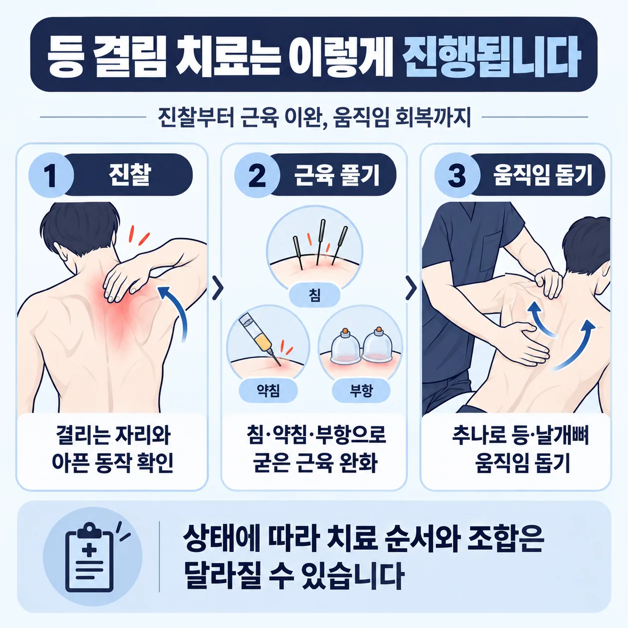 등 결림 치료 순서를 진찰, 근육 풀기, 추나 세 단계로 이은 흐름 도식